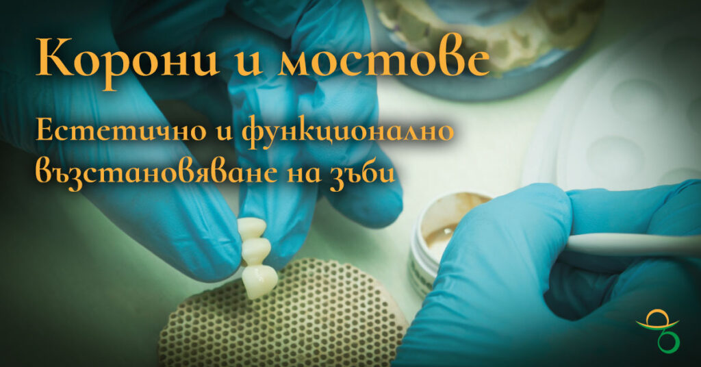 Корони и мостове – естетично и функционално възстановяване на зъби | зъболекар Хасково