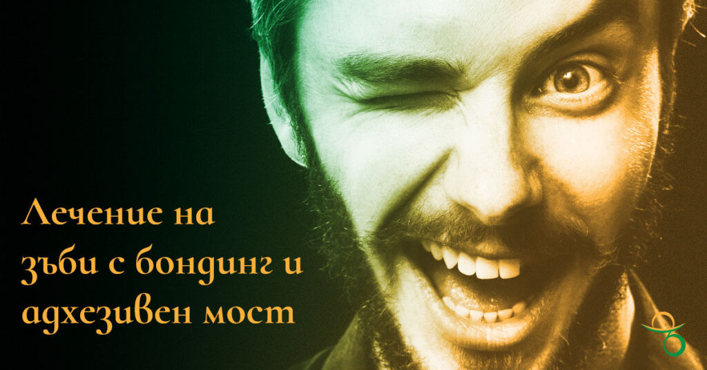Лечение на зъби с бондинг и адхезивен мост | зъболекар Хасково